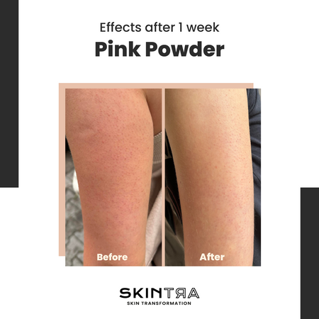 Pink Pow(d)er