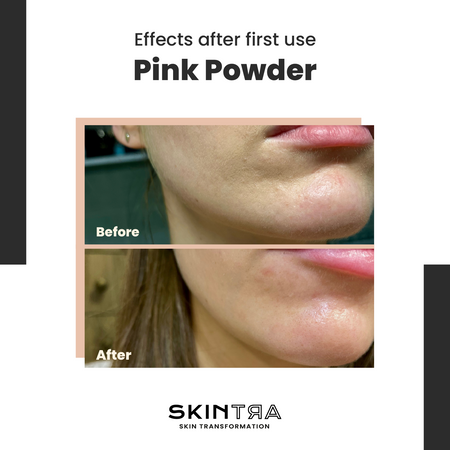 Pink Pow(d)er