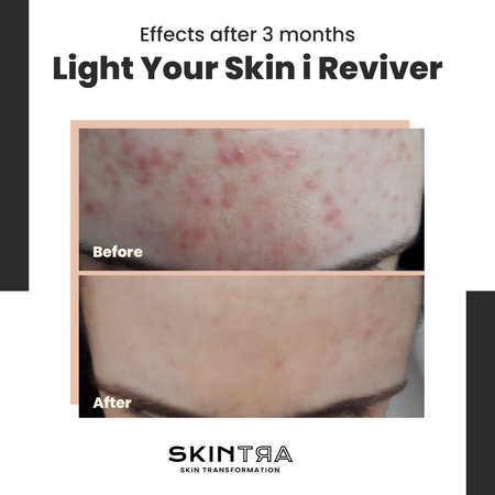Reviver