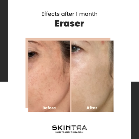 Eraser