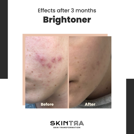 Brightoner