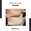 Eraser